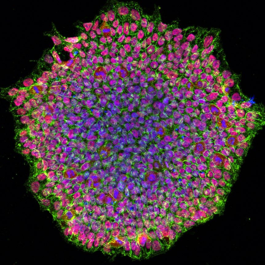 ヒトのiPS細胞のコロニー（資料写真・NIH）
